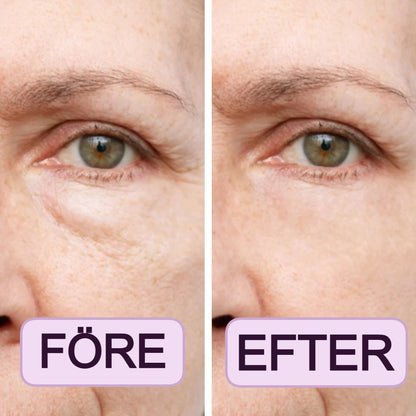 MyEyes Koreanska Eye Pads - Utvilade ögon På 10 Minuter